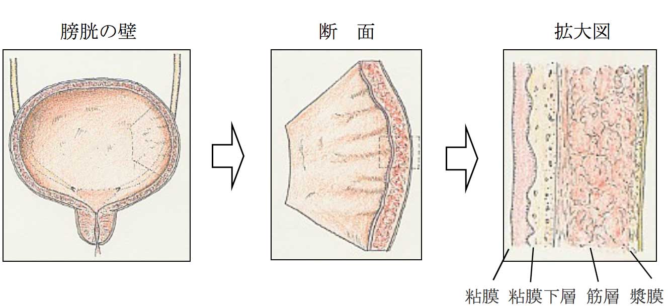 膀胱壁とその断面